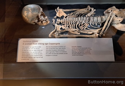 skeleton details